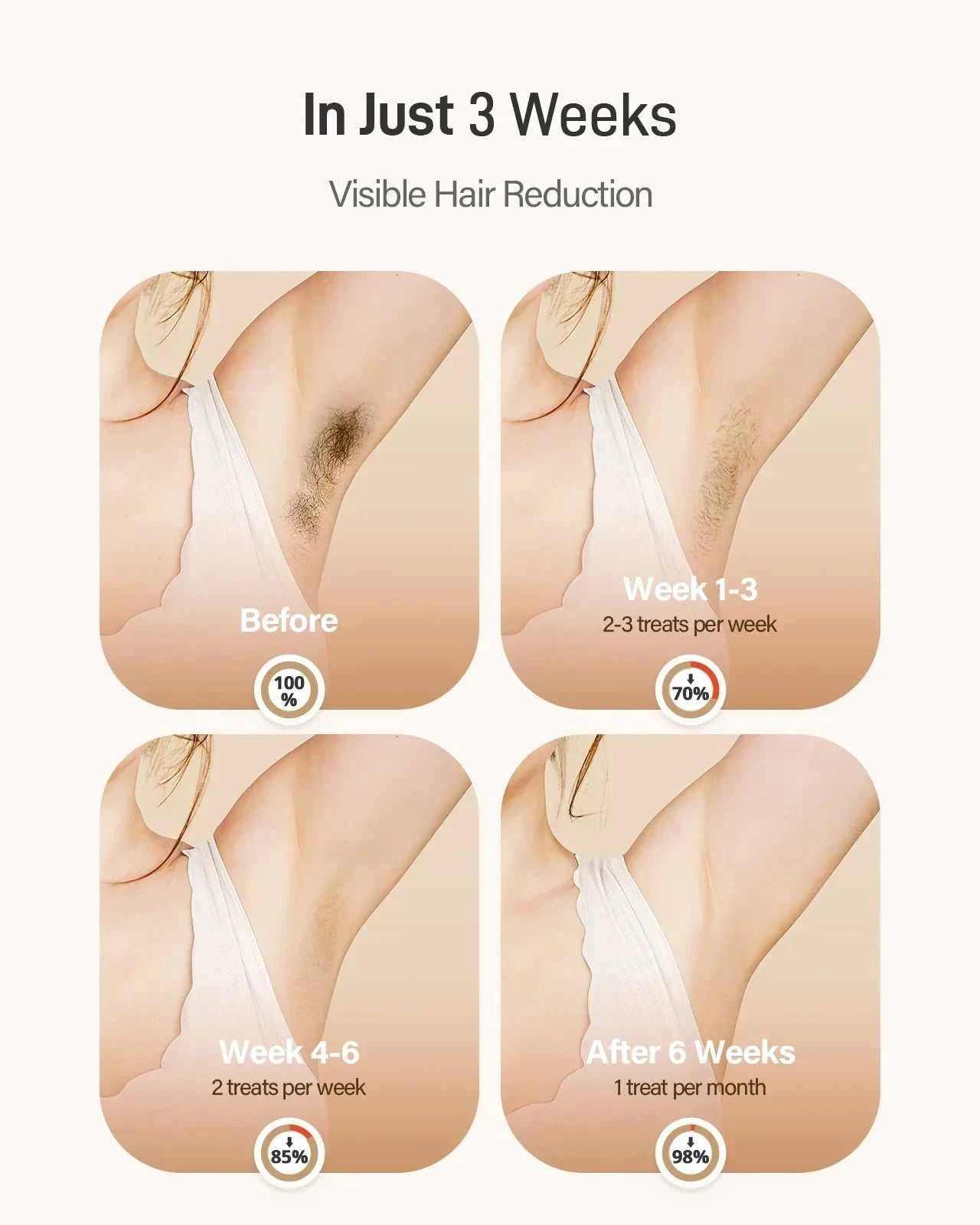 IPL Hair Removal Device